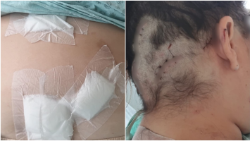 Homem preso por torturar e tentar matar companheira com 12 facadas foi encontrado com arma de fogo e drogas