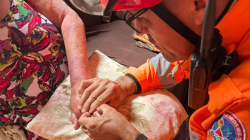 VÍDEO: Chikungunya causa inchaço e leva pacientes a acionar bombeiros por alianças presas em MG